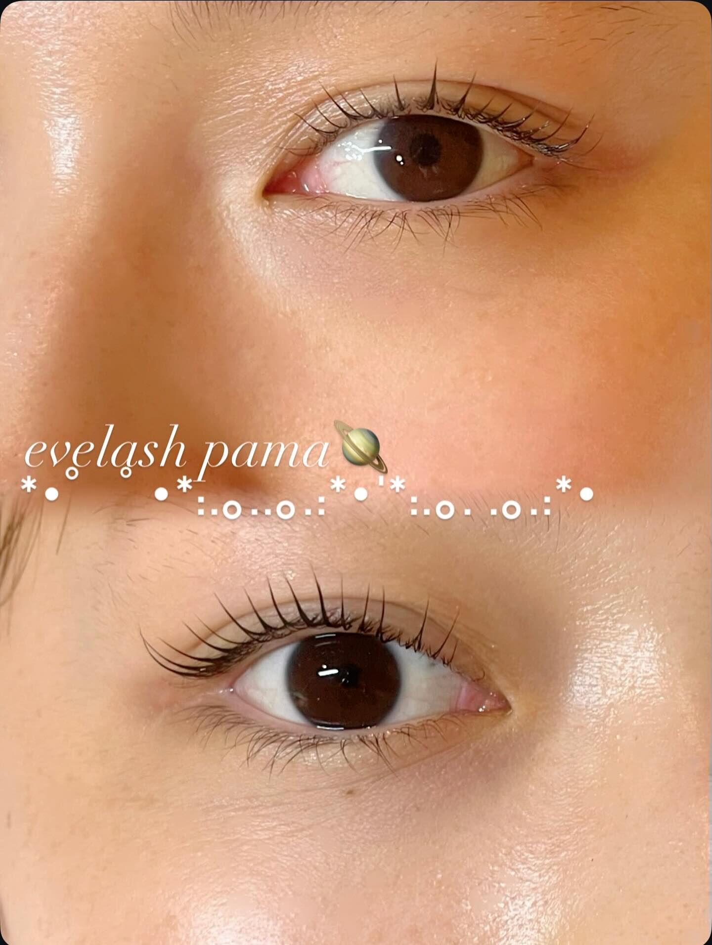👁メーテルロッドでつくる“美しい立ち上がり”
